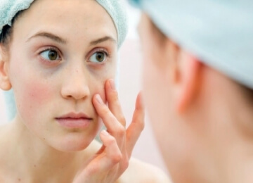 Preenchimento de Olheiras 